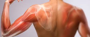 کشیدگی عضله یکی از شایعترین علل کمر درد ناگهانی است